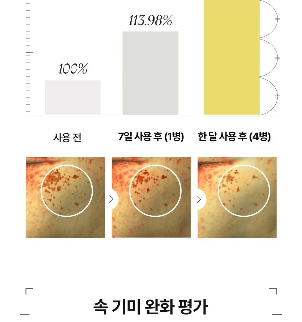 [미백앰플] 아떼 멜레이저 프로그래밍 앰플 10ml 5+1 상세페이지 33